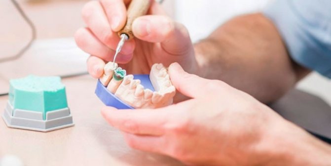 Зубной техник делает протез